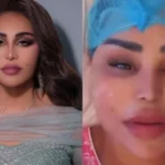 أحلام-تكشف-تفاصيل-إجراء-تجميلي-جديد-لشد-الوجه-أخبار.webp.webp